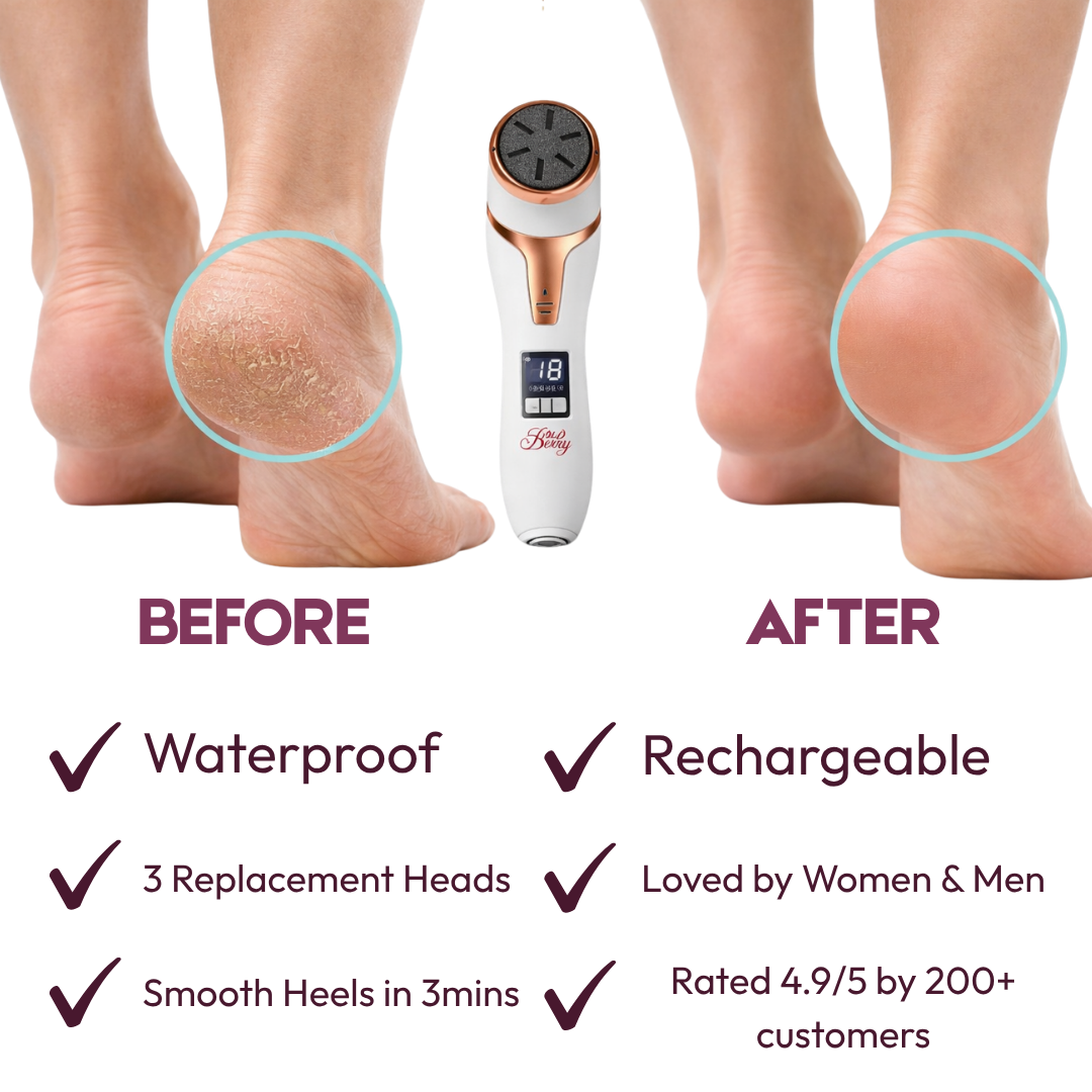 Quartz Rechargeable Foot Callus Remover