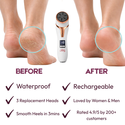 Quartz Rechargeable Foot Callus Remover