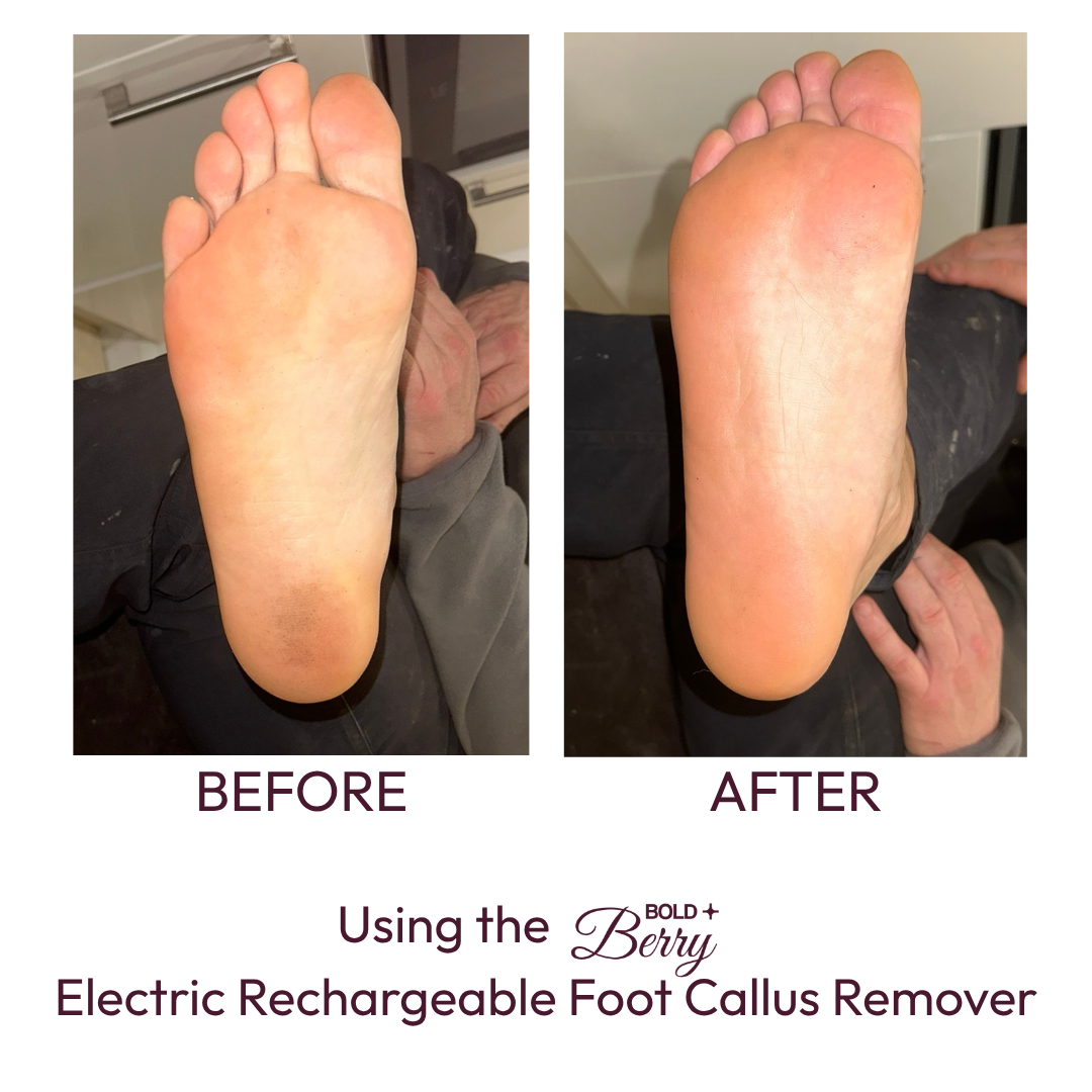Quartz Rechargeable Foot Callus Remover